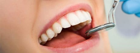Close-up of a smiling mouth with a dental mirror at the teeth — Why do Dentists Drill a Cavity?