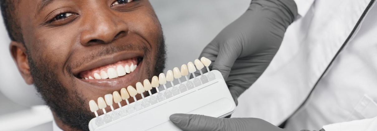 Smiling man beside a veneer shade guide — Transform Your Smile with Custom Veneers in Fort Collins
